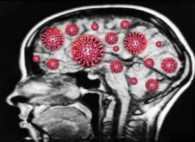 ویروس کرونا بعد از بهبودی بیمار در مغز باقی می ماند